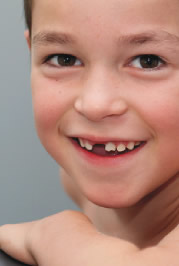 Junge mit fehlendem Zahn